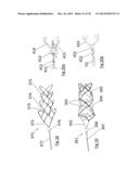 CLOT RETRIEVAL DEVICE FOR REMOVING OCCLUSIVE CLOT FROM A BLOOD VESSEL diagram and image