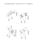 CLOT RETRIEVAL DEVICE FOR REMOVING OCCLUSIVE CLOT FROM A BLOOD VESSEL diagram and image