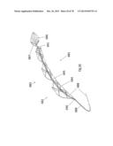 CLOT RETRIEVAL DEVICE FOR REMOVING OCCLUSIVE CLOT FROM A BLOOD VESSEL diagram and image