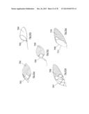 CLOT RETRIEVAL DEVICE FOR REMOVING OCCLUSIVE CLOT FROM A BLOOD VESSEL diagram and image