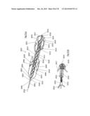 CLOT RETRIEVAL DEVICE FOR REMOVING OCCLUSIVE CLOT FROM A BLOOD VESSEL diagram and image