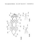 CLOT RETRIEVAL DEVICE FOR REMOVING OCCLUSIVE CLOT FROM A BLOOD VESSEL diagram and image