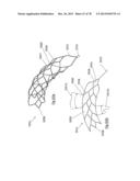 CLOT RETRIEVAL DEVICE FOR REMOVING OCCLUSIVE CLOT FROM A BLOOD VESSEL diagram and image