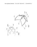 CLOT RETRIEVAL DEVICE FOR REMOVING OCCLUSIVE CLOT FROM A BLOOD VESSEL diagram and image