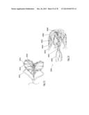 CLOT RETRIEVAL DEVICE FOR REMOVING OCCLUSIVE CLOT FROM A BLOOD VESSEL diagram and image