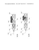 CLOT RETRIEVAL DEVICE FOR REMOVING OCCLUSIVE CLOT FROM A BLOOD VESSEL diagram and image