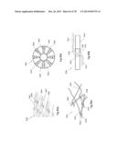 CLOT RETRIEVAL DEVICE FOR REMOVING OCCLUSIVE CLOT FROM A BLOOD VESSEL diagram and image