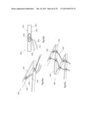 CLOT RETRIEVAL DEVICE FOR REMOVING OCCLUSIVE CLOT FROM A BLOOD VESSEL diagram and image