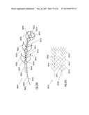 CLOT RETRIEVAL DEVICE FOR REMOVING OCCLUSIVE CLOT FROM A BLOOD VESSEL diagram and image