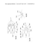 CLOT RETRIEVAL DEVICE FOR REMOVING OCCLUSIVE CLOT FROM A BLOOD VESSEL diagram and image