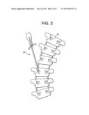 Image Guided Intra-Operative Contouring Aid diagram and image