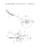 SPINAL ROD LOCKING HOLDER diagram and image