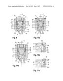 POLYAXIAL BONE ANCHORING DEVICE diagram and image