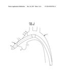 APPARATUS AND METHOD FOR AORTIC PROTECTION AND TAVI PLANAR ALIGNMENT diagram and image