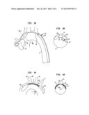 APPARATUS AND METHOD FOR AORTIC PROTECTION AND TAVI PLANAR ALIGNMENT diagram and image