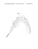 APPARATUS AND METHOD FOR AORTIC PROTECTION AND TAVI PLANAR ALIGNMENT diagram and image