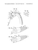 APPARATUS AND METHOD FOR AORTIC PROTECTION AND TAVI PLANAR ALIGNMENT diagram and image