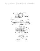 IMPLANTABLE DEVICES FOR CONTROLLING THE SIZE AND SHAPE OF AN ANATOMICAL     STRUCTURE OR LUMEN diagram and image