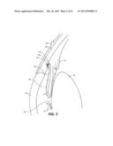 INTRAOCULAR IMPLANTS AND RELATED KITS AND METHODS diagram and image