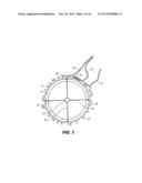 INTRAOCULAR IMPLANTS AND RELATED KITS AND METHODS diagram and image