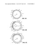 INTRAOCULAR IMPLANTS AND RELATED KITS AND METHODS diagram and image