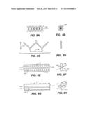 INTRAOCULAR IMPLANTS AND RELATED KITS AND METHODS diagram and image