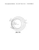 INTRAOCULAR IMPLANTS AND RELATED KITS AND METHODS diagram and image