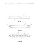 INTRAOCULAR IMPLANTS AND RELATED KITS AND METHODS diagram and image