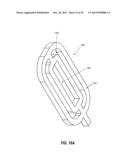 INTRAOCULAR IMPLANTS AND RELATED KITS AND METHODS diagram and image