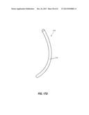 INTRAOCULAR IMPLANTS AND RELATED KITS AND METHODS diagram and image