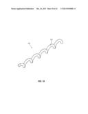 INTRAOCULAR IMPLANTS AND RELATED KITS AND METHODS diagram and image