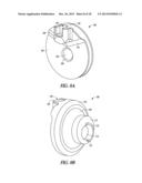 ELBOW PROSTHESIS diagram and image