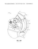 ELBOW PROSTHESIS diagram and image