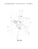 ELBOW PROSTHESIS diagram and image