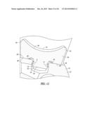 ELBOW PROSTHESIS diagram and image