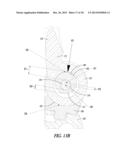 ELBOW PROSTHESIS diagram and image