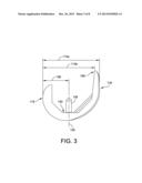 KNEE IMPLANT SYSTEM diagram and image