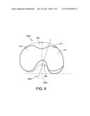 KNEE IMPLANT SYSTEM diagram and image