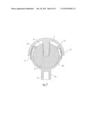 Interlocking Reverse Hip Revision Prosthesis and Method diagram and image