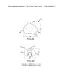 ARTHROPLASTY SYSTEM AND RELATED METHODS diagram and image