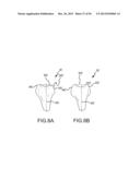 ARTHROPLASTY SYSTEM AND RELATED METHODS diagram and image