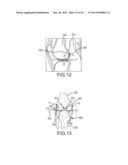 ARTHROPLASTY SYSTEM AND RELATED METHODS diagram and image