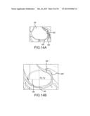 ARTHROPLASTY SYSTEM AND RELATED METHODS diagram and image