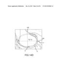 ARTHROPLASTY SYSTEM AND RELATED METHODS diagram and image