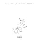 ARTHROPLASTY SYSTEM AND RELATED METHODS diagram and image