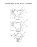 ARTHROPLASTY SYSTEM AND RELATED METHODS diagram and image