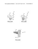 ARTHROPLASTY SYSTEM AND RELATED METHODS diagram and image