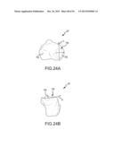 ARTHROPLASTY SYSTEM AND RELATED METHODS diagram and image