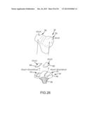 ARTHROPLASTY SYSTEM AND RELATED METHODS diagram and image