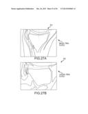 ARTHROPLASTY SYSTEM AND RELATED METHODS diagram and image